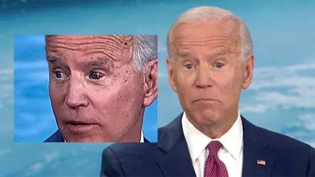 Joe Biden's Bleeding Eye meme card