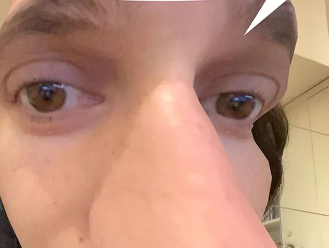 Meme Maxime's nose