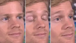 Blinking White Guy meme card, rare rarity