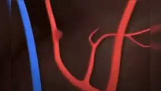 Carte meme Brain Fart / Aneurysm Animation, rareté commune
