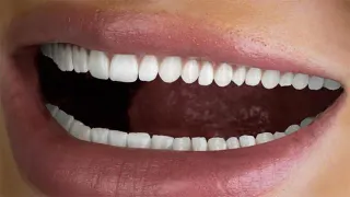Carte meme Hi Smile Tiny Teeth Advertisement, rareté commune