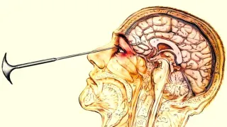 Carte meme Lobotomy (Slang), rareté commune