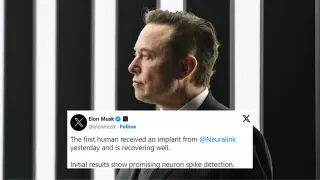 Neuralink Brain Chip Implant meme card, common rarity