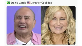 Stênio Garcia's Facial Harmonization meme card, common rarity