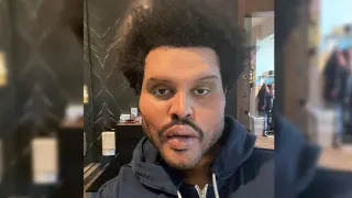Carte meme The Weeknd’s Plastic Surgery Face, rareté commune