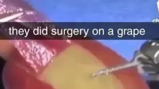 They Did Surgery On a Grape meme card, epic rarity
