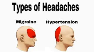 Carte meme Types of Headaches, rareté rare